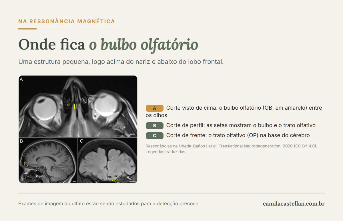Ressonância magnética mostrando a localização do bulbo olfatório humano
