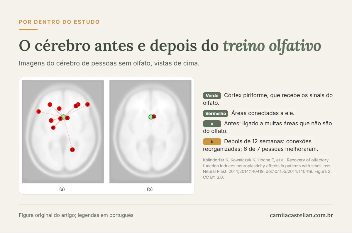 Figura de estudo científico: conexões do córtex olfatório no cérebro de pessoas sem olfato antes e depois de 12 semanas de treino olfativo
